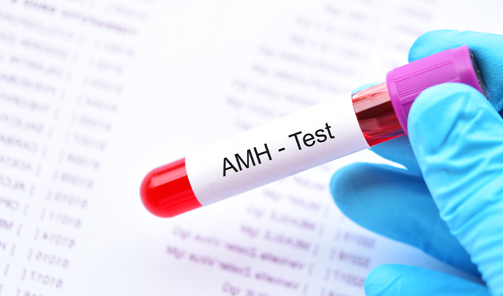 Amh Test Price In Delhi | Nandi Ivf